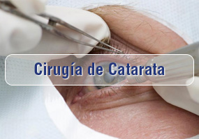 Cirugía de Catarata