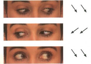 oculareslaterales-300x211