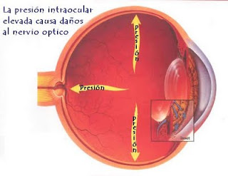 glaucoma_anatomy