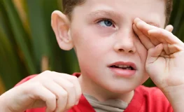 Las Alergias Oculares: Síntomas, Desencadenantes y Tratamiento