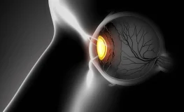 Día Mundial de la Radiología El Poder del Diagnóstico por Imagen en el Ojo