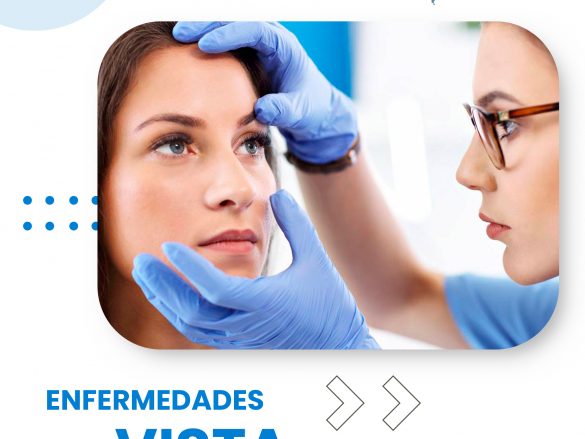 ¿Cuáles son las 10 enfermedades de la vista más comunes?
