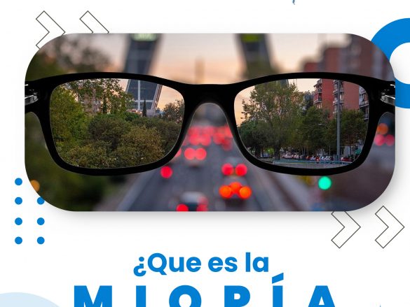 ¿Qué es la miopía y sus síntomas?
