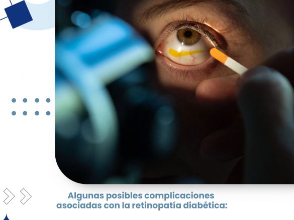 ¿Qué es el desprendimiento de la retina?