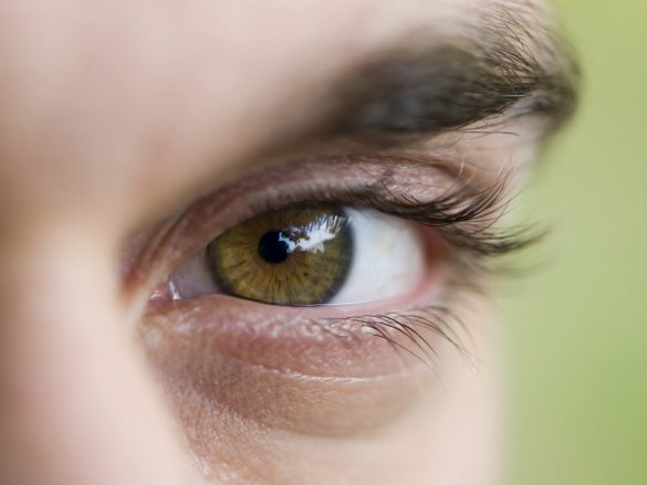 La retinopatía diabética, puede causar perdida de la visión de manera irreversible.
