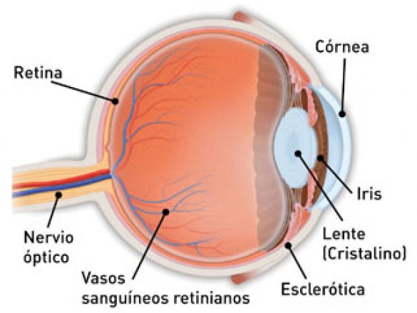 ¿Qué es  la Retinopatía Diabética?