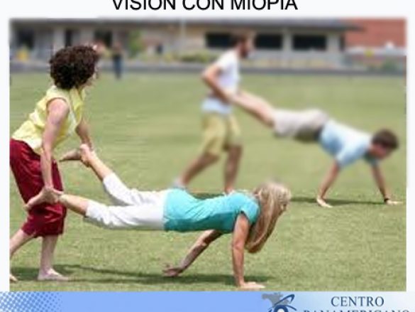 Visión corta o Miopía
