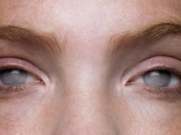 ¿Qué es la ceguera?