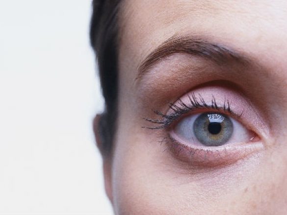 Lo que debes saber del Glaucoma