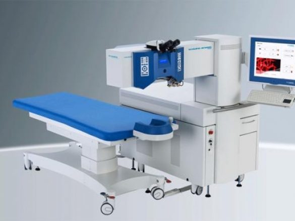 Cirugía Refractiva con Láser Excimer