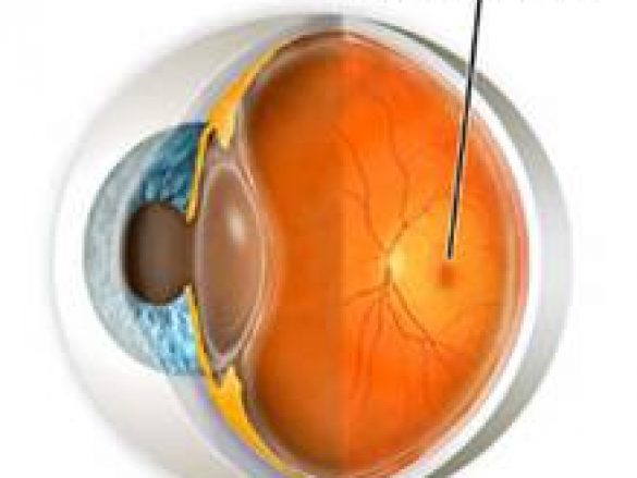 Degeneración macular