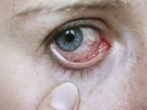 ¿Cómo afecta a tus ojos regresar al trabajo después de vacaciones?