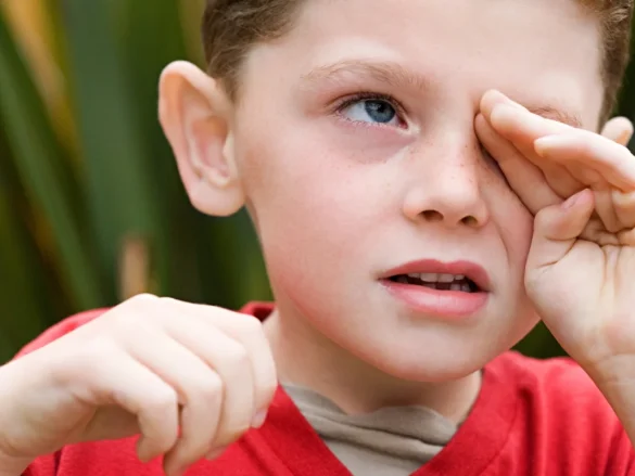 Las Alergias Oculares: Síntomas, Desencadenantes y Tratamiento