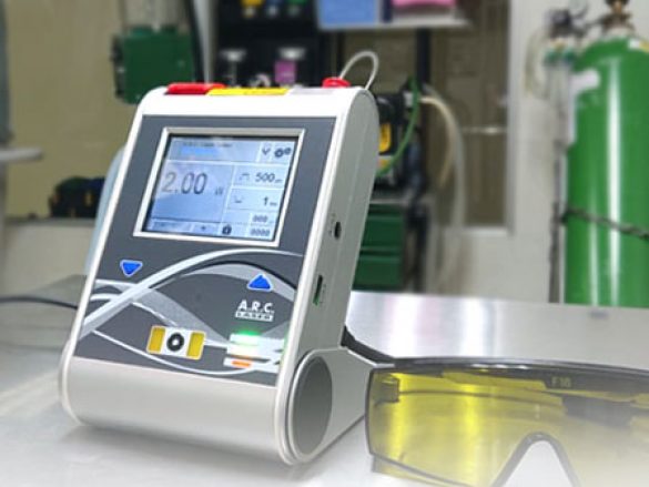 Láser Fox: tratamiento de glaucoma refractario