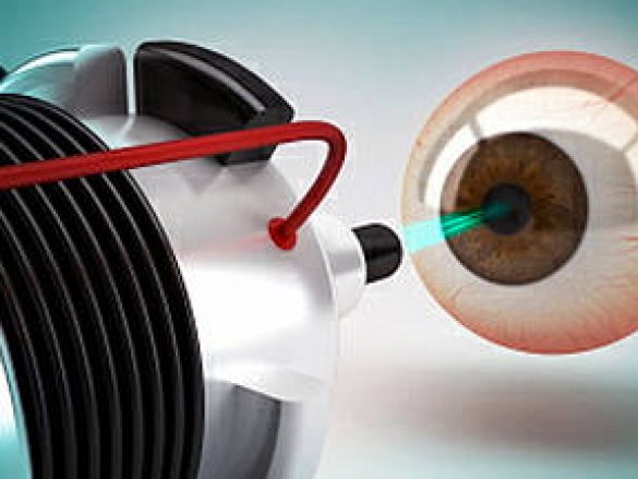 ¿Qué es el láser femtosegundo?