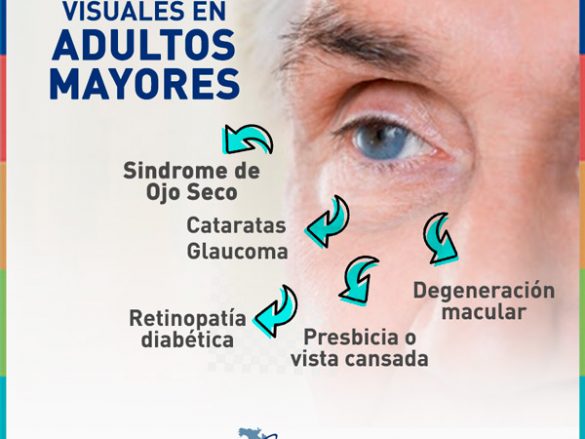 Padecimientos visuales en adultos mayores