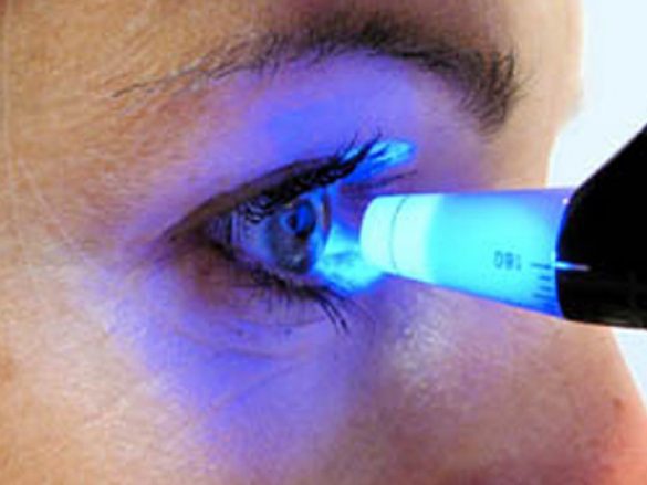 Presión Intraocular
