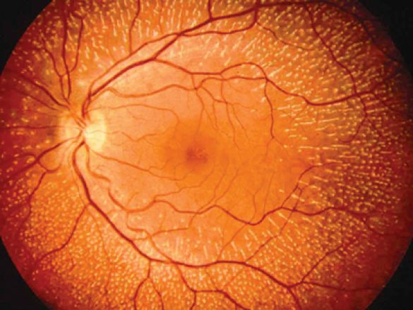 ¿Cómo se puede examinar la retina?