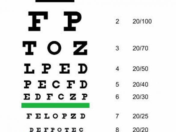 ¿Conoces el Test de Snellen?