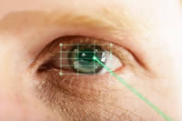 Laser en oftalmologia
