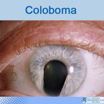 El iris y enfermedades