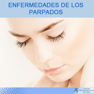 Enfermedades de los parpados