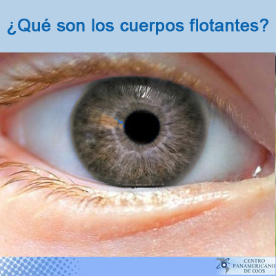 ¿Qué son los cuerpos flotantes?