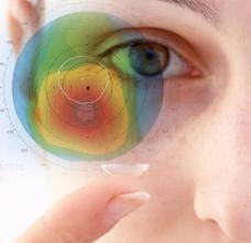 ¿Cómo se diagnostica el queratocono?