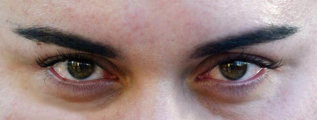 Enfermedades de la vista