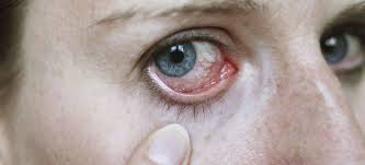 ¿Cómo afecta a tus ojos regresar al trabajo después de vacaciones?