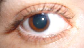 ¿Qué es la pupila?