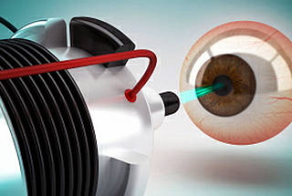 ¿Qué es el láser femtosegundo?