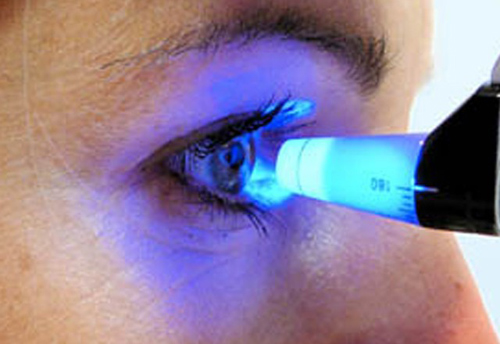 Presión Intraocular