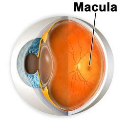 El Agujero Macular