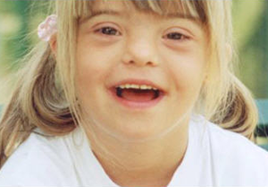 Problemas visuales en las personas con Síndrome de Down.