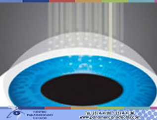 ¿Qué es el Crosslinking?