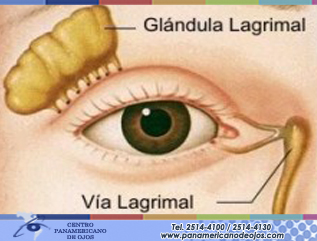 Obstrucción de Vías Lagrimales