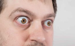 Enfermedad Ocular Tiroidea: Más allá de los ojos saltones