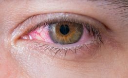 Retinopatía Hipertensiva: Lo que tus ojos dicen de tu presión